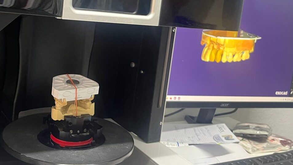 3D Dental Scanner CAD